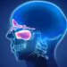How to Tell If a Sinus Infection Has Spread to the Brain