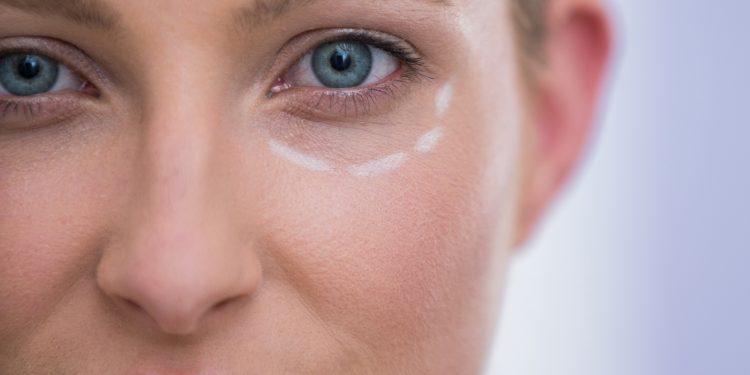 Close-up of woman with marks drawn for botox procedure