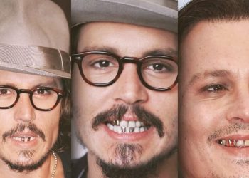Johnny Depp Teeth