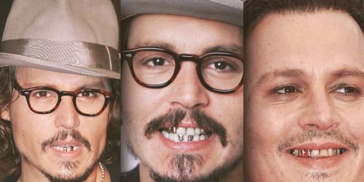 Johnny Depp Teeth