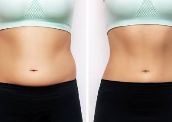 Two shots of a woman's belly with excess fat and toned slim stomach with abs before and after losing weight isolated on a white background. Result of diet, liposuction, training. Healthy lifestyle