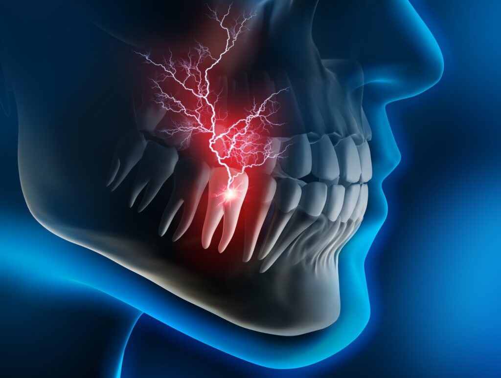 kill tooth pain nerve in 3 seconds permanently