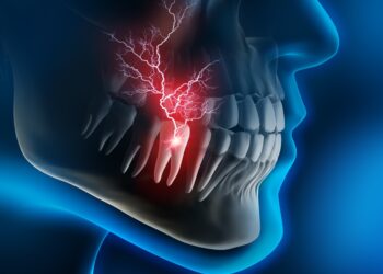 kill tooth pain nerve in 3 seconds permanently