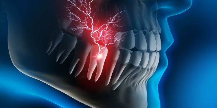 kill tooth pain nerve in 3 seconds permanently